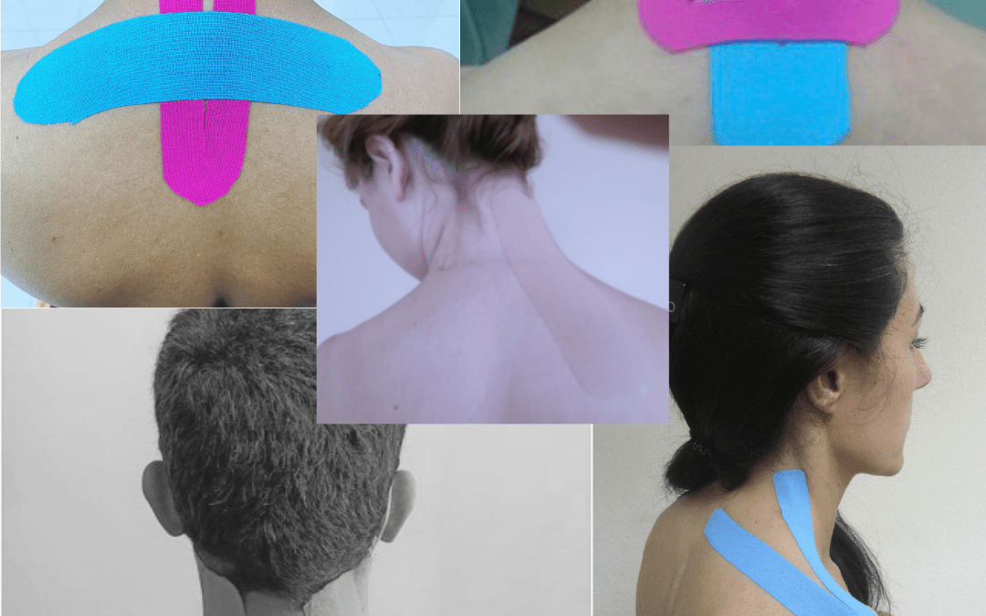 Effects of Kinesio Taping on Neck Pain: A very recent Study – Rocktape UK