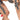 Myofascial Cupping Revival